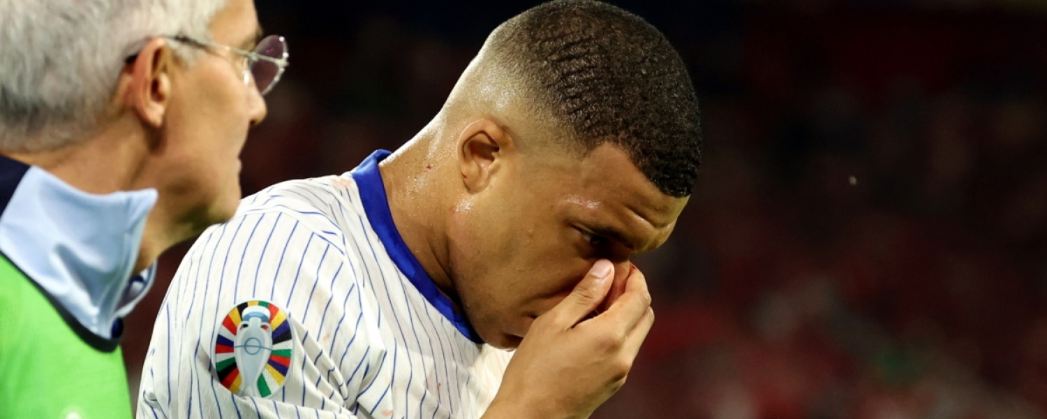 Kylian Mbappé Sufre Fractura de Nariz en la Eurocopa 2024